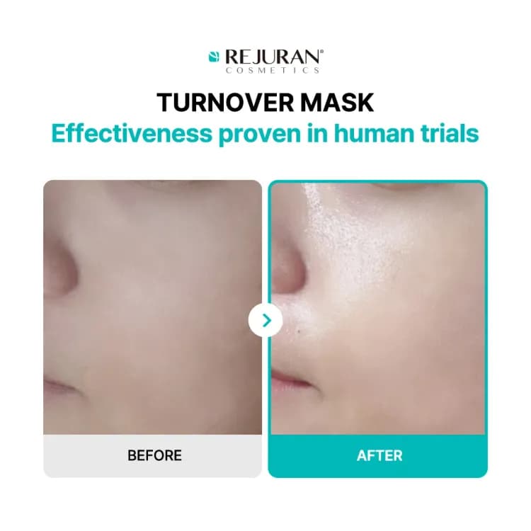 Rejuran Turnover Mask 1ea