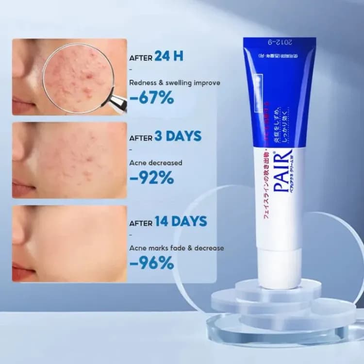 Lion Pair Acne Cream W 14g