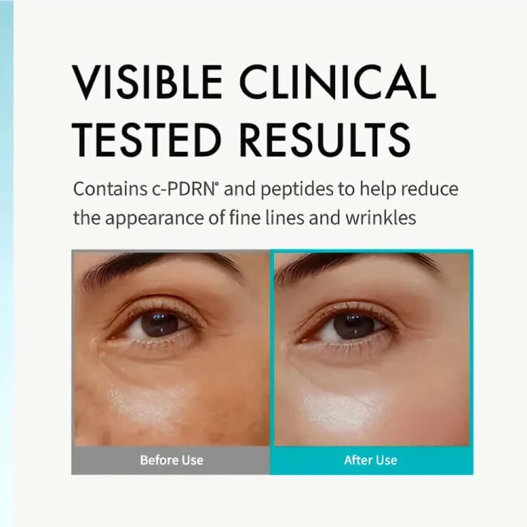 Rejuran Intensive Eye Cream 20ml