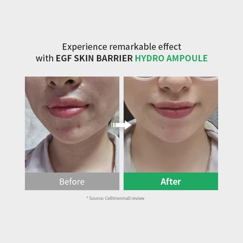 Zipiderm Egf Skin Barrier Hydro Ampoule 30ml