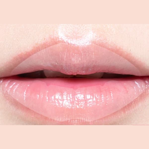 Acropass Jolly Filly Lip Plumping Patch