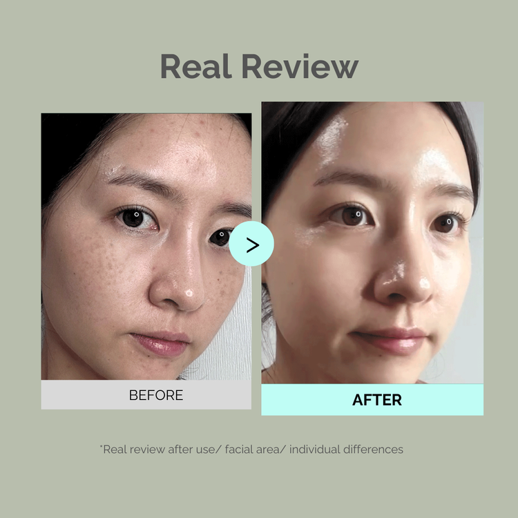 Moomy Care Perilla Cream Plus 50g