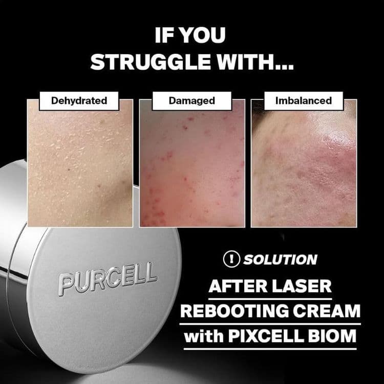 Purcell Pixcell Biom 5+ Probiotics Reebooting Cream