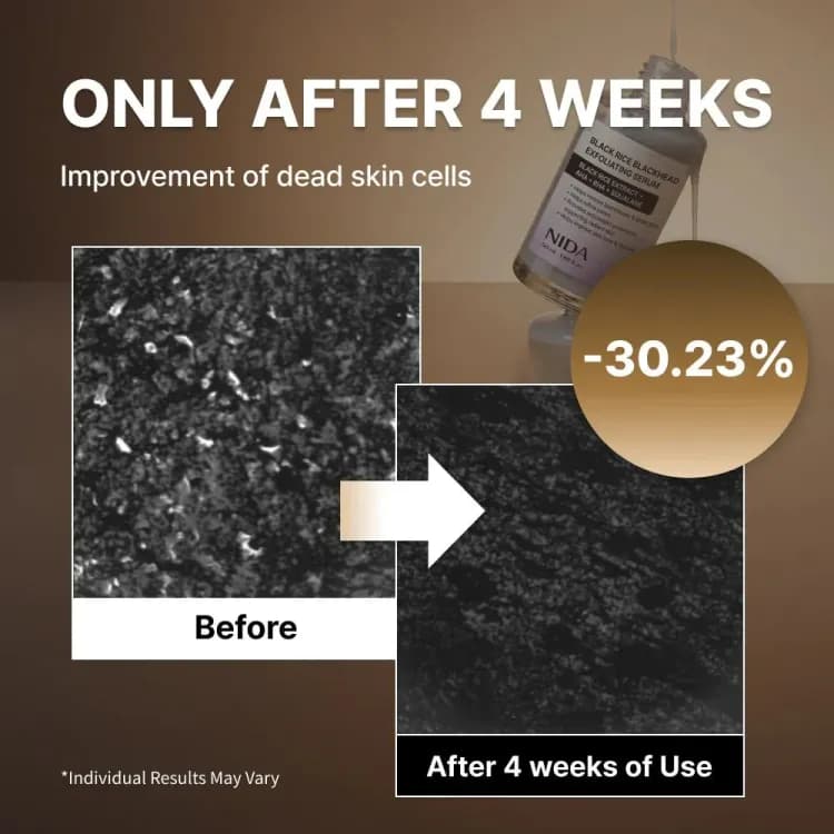Nida Black Rice Blackhead Exfoliating Serum