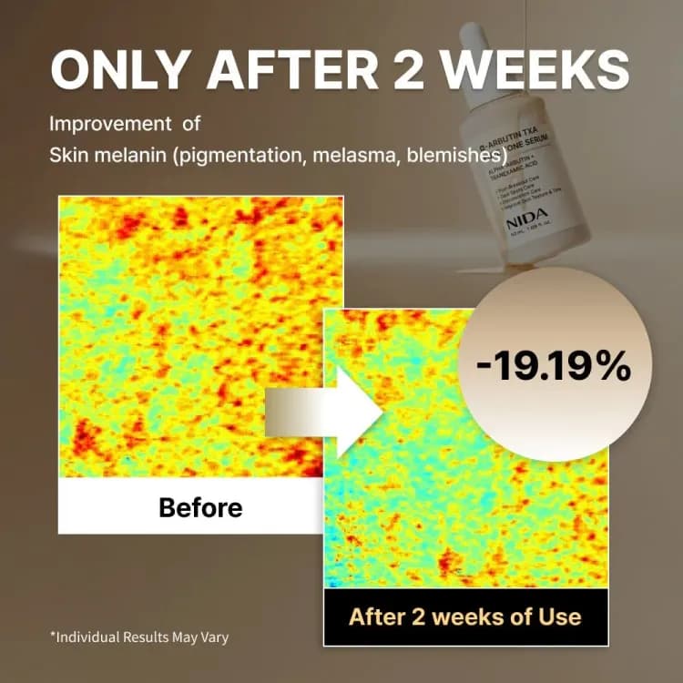 Nida Α-arbutin Txa Pure Tone Serum