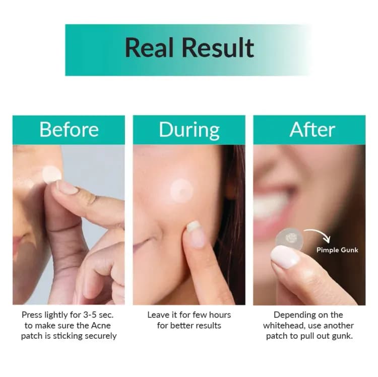 Some By Mi Clear Patch 18pcs