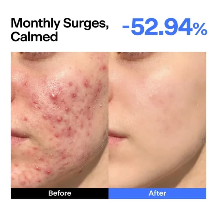 Thome Abc Triple-synergy Redness Comfort Serum